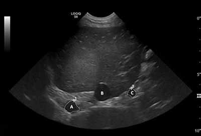 Sildenafil does not have a significant effect on the portal vein velocity, cross-sectional area, and congestion index in the dog